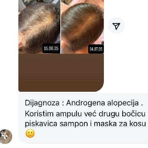 rossen-piskavica-sampon-tretman-za-rast-kose-dijagnoza-1001236 jpg