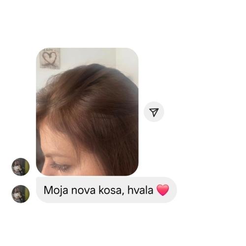 rossen-1001234-zadovoljna-korisnica-rast-kose-piskavica-ampula