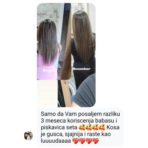 rossen-1001234-slika-rezultat-piskavica-ampula