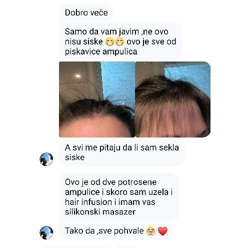 rossen-1001234-pohvala-za-piskavica-tretman-ampula