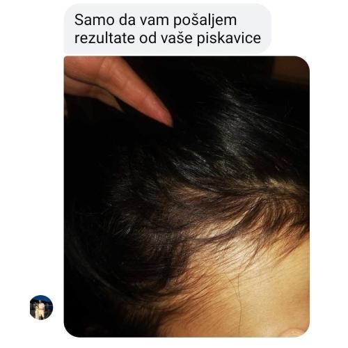 rossen-1001234-rast-kose-na-razdjeljku-prije-poslije-ampula