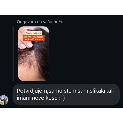 rossen-10012344-utisci-zadovoljne-korisnice-piskavica-ampula