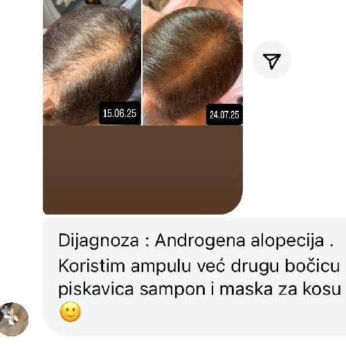 rossen-10012344-androgena-alopecija-rezultati-piskavica-duo-ampula