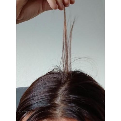 rossen-10012344-rast-nove-baby-hair-kose-piskavica-duo-ampula