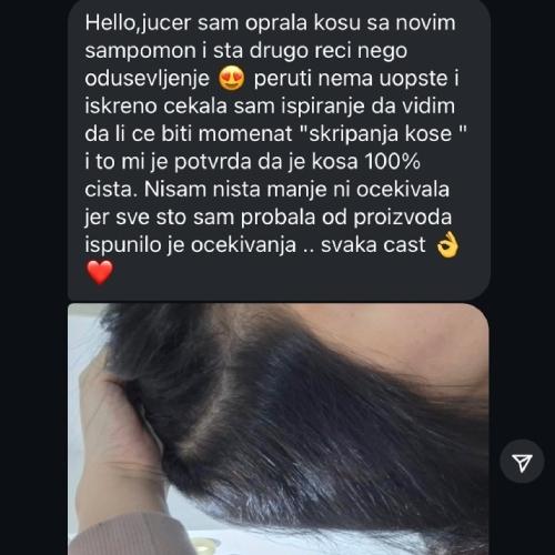 rossen-sampon-protiv-peruti-dugotrajno-rjesenje-za-perut-utisci-1001227 jpg