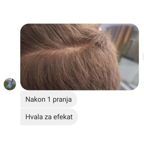 rossen-sampon-protiv-peruti-brzo-djelovanje-na-perut-rezultat-1001227 jpg