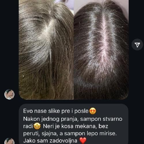 rossen-kako-umiriti-svrab-tjemena-savjeti-1001228 jpg