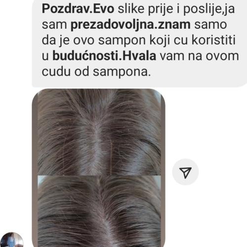 rossen-iskustvo-korisnika-losion-za-skalp-1001228 jpg