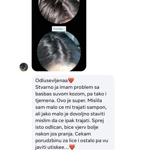 rossen-cisto-tjeme-bez-iritacija-prikaz-1001228 jpg