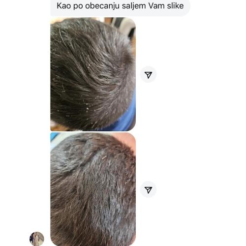 rossen-zdrava-koza-glave-bez-ljuskanja-1001228 jpg