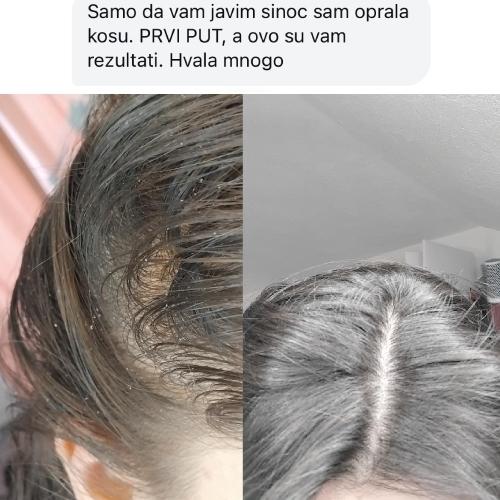 rossen-recenzija-umirujuci-losion-preporuka-1001228 jpg