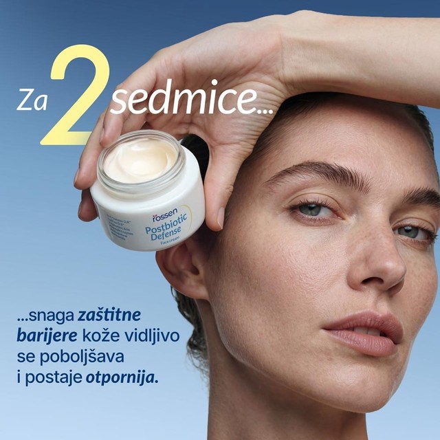 rezultati-nakon-dvije-sedmice-koristenja-seta-za-lice-sa-probiotikom-10012608-rossen