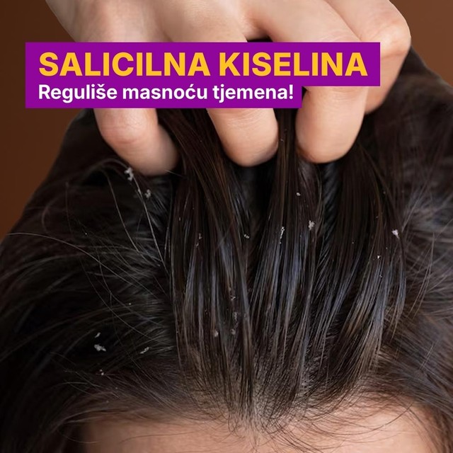 rossen-piskavica-losion-salicilna-kiselina-za-masno-vlasiste-1001235 jpg
