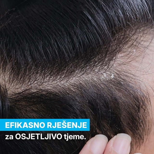 rossen-rjesenje-za-osjetljivo-tjeme-perut-1001228 jpg